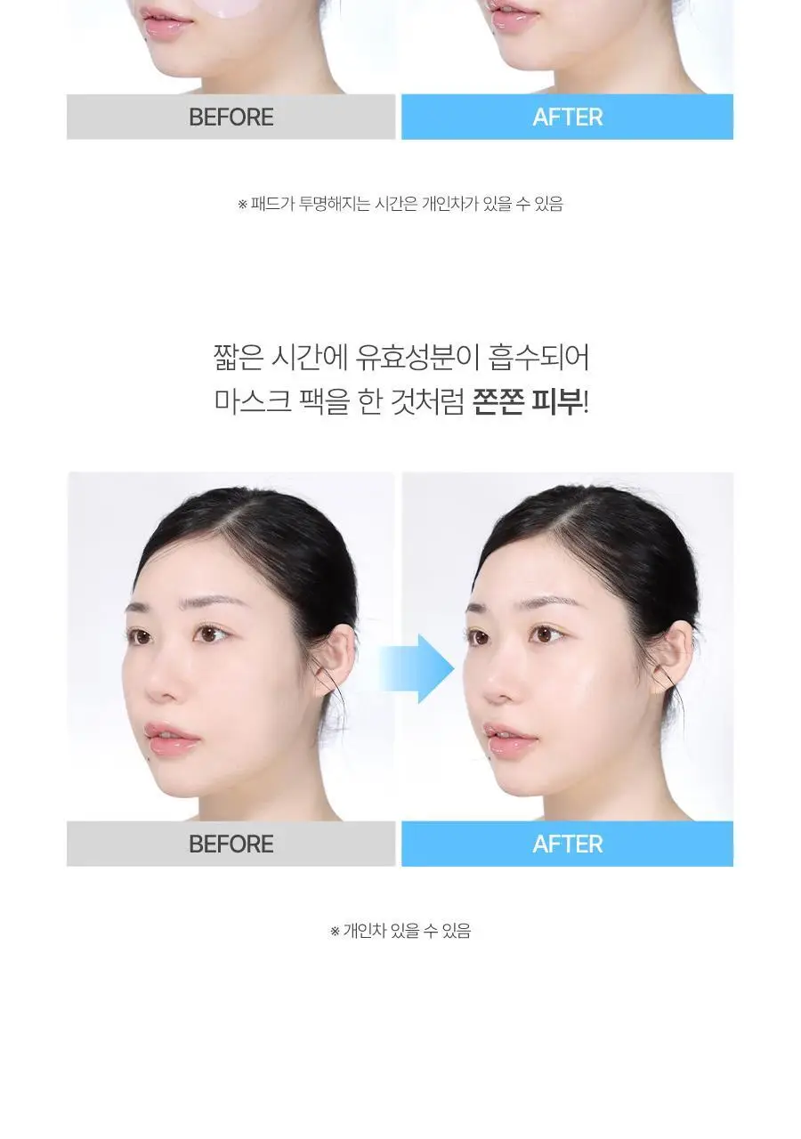 [100%리뷰이벤트] NEW 노프랍 하이드로겔 패드 3종 (콜라겐/수분/모공) 상세페이지 19